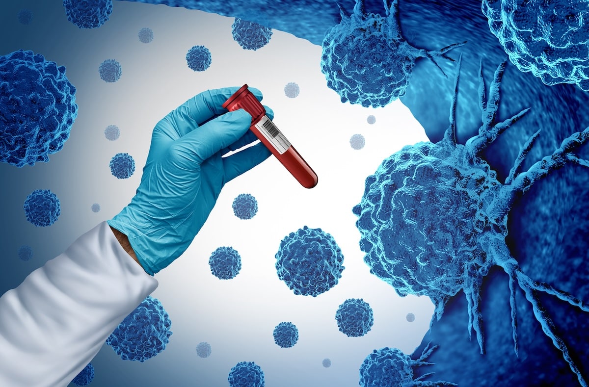 Dépistage du cancer : la promesse OncoDiag