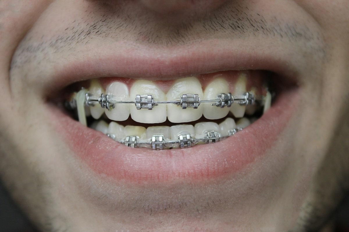 Combien gagne un orthodontiste ?